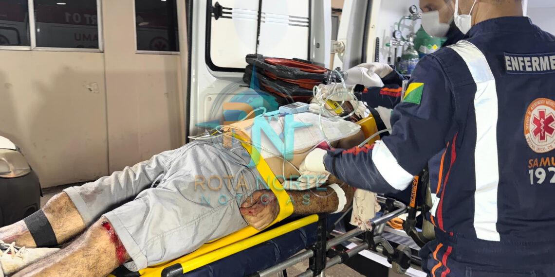 Tapeceiro sofre traumatismo craniano após bater moto em poste em Rio Branco