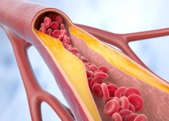 Por que reduzir o colesterol LDL é decisivo para proteger o coração