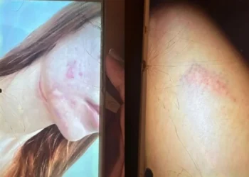 Ex-namorada de pai de santo denuncia agressões e cárcere privado