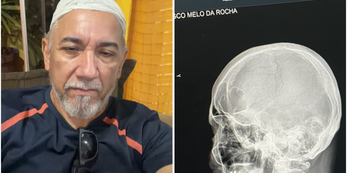 Jornalista é agredido durante invasão em Cruzeiro do Sul
