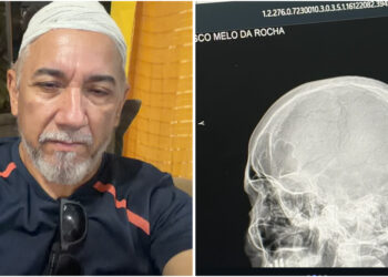 Jornalista é agredido durante invasão em Cruzeiro do Sul