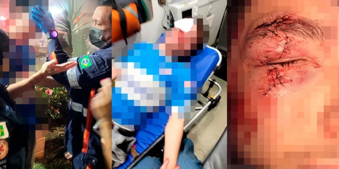 Águas Claras: morador de rua desfigura rosto de jovem e é solto no mesmo dia