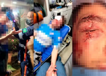 Águas Claras: morador de rua desfigura rosto de jovem e é solto no mesmo dia