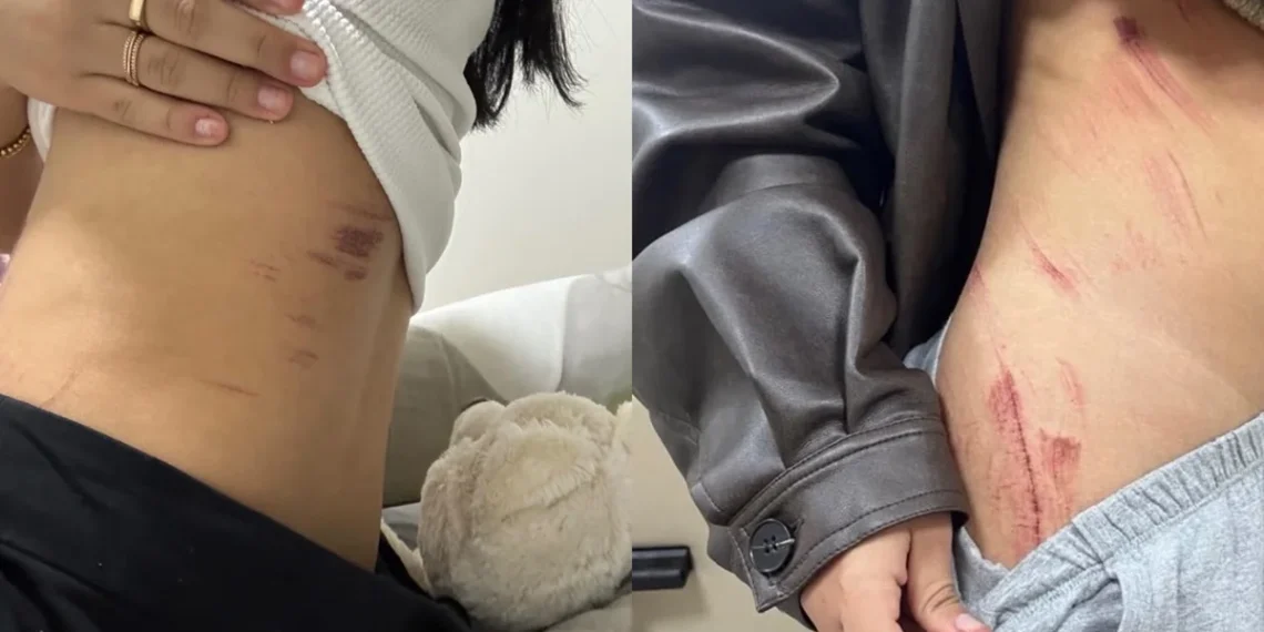 Casal lésbico narra momentos de horror durante estupro: “Queria o nosso desespero”