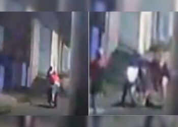 Homem vê namorada ser roubada, tenta protegê-la e é baleado na cabeça