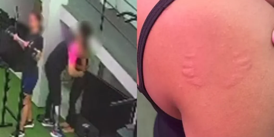 Mulher é assediada ao ser agarrada e mordida por instrutor em academia