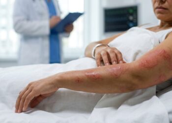 Clínica de estética é condenada a indenizar cliente por queimaduras de 2º grau em bronzeamento artificial