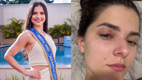 Empresário é condenado por agredir e ameaçar ex-Miss Universo Rio Branco após crise de ciúmes