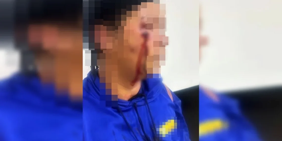 Mulher é chicoteada após ser acusada de relação com homem casado no Entorno