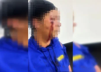 Mulher é chicoteada após ser acusada de relação com homem casado no Entorno